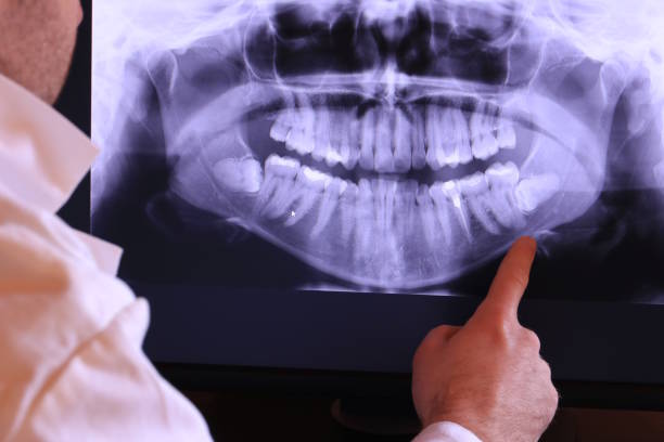Best Emergency Dentist for Lost Fillings or Crowns in Shasta Lake, CA