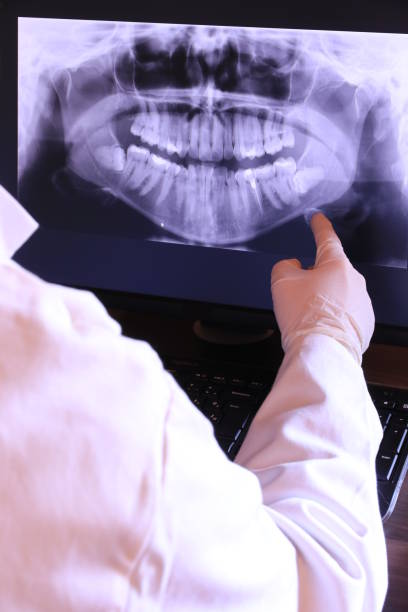 Best Emergency Dentist for Knocked-Out Tooth in Shasta Lake, CA